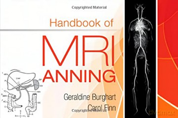 Handbook Of Mri Scanning - Geraldine Burghart [KSIĄŻKA]