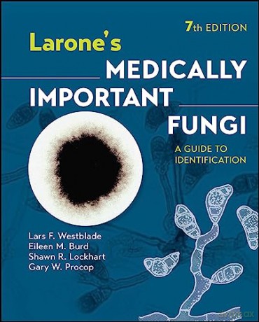 Larone's Medically Important Fungi: A Guide to Identification - Lars F. Westblade [KSIĄŻKA]