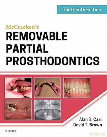 McCracken's Removable Partial Prosthodontics - Alan Carr [KSIĄŻKA]