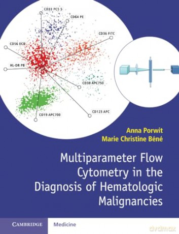 Multiparameter Flow Cytometry in the Diagnosis of Hematologic Malignancies - Anna Porwit [KSIĄŻKA]