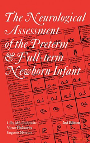 Neuro Assess Pre Term Infant 2ed - Dubowitz Lilly M. S [KSIĄŻKA]