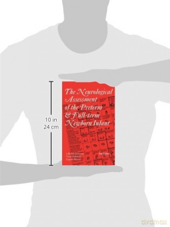Neuro Assess Pre Term Infant 2ed - Dubowitz Lilly M. S [KSIĄŻKA]