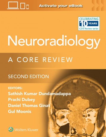 Neuroradiology 2e - Prachi, Dubey [KSIĄŻKA]