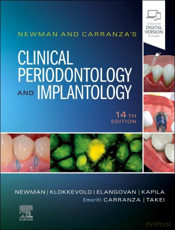 Newman and Carranza's Clinical Periodontology and Implantology - Michael G. Newman [KSIĄŻKA]