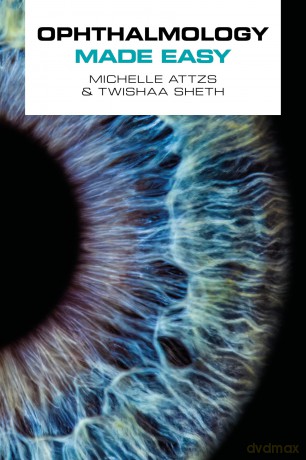 Ophthalmology Made Easy [KSIĄŻKA]