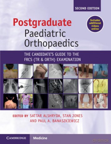 Postgraduate Paediatric Orthopaedics - Sattar Alshryda [KSIĄŻKA]