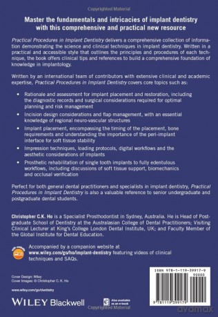 Practical Procedures in Implant Dentistry - Christopher C. K Ho [KSIĄŻKA]