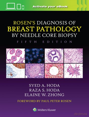 Rosens Diagnosis Of Breast Pathology By - Syed, A. Hoda [KSIĄŻKA]
