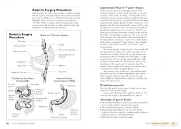 The Complete Bariatric Surgery Guide and Diet Program: Includes 150 Recipes for Lifelong Weight-Loss Success - Sue Ekserci [KSIĄŻKA]