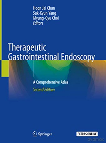 Therapeutic Gastrointestinal Endoscopy - Chun [KSIĄŻKA]