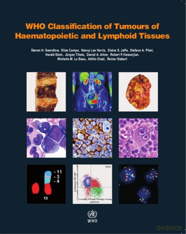 WHO classification of tumours of haematopoietic and lymphoid tissues: Vol. 2 - Who [KSIĄŻKA]