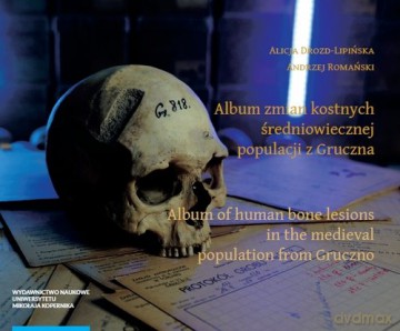 Album zmian kostnych średniowiecznej populacji z Gruczna - Alicja Drozd-Lipińska, Andrzej Romański [KSIĄŻKA]