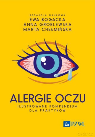 Alergie oczu. Ilustrowane kompendium dla praktyków - Ewa Bogacka, Anna Groblewska [KSIĄŻKA]