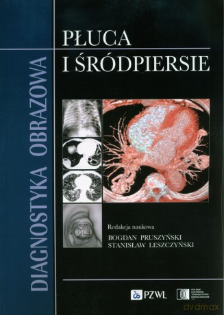 Diagnostyka obrazowa Płuca i śródpiersie [KSIĄŻKA]