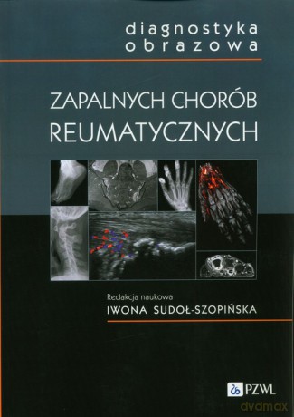 Diagnostyka obrazowa zapalnych chorób reumatycznych [KSIĄŻKA]