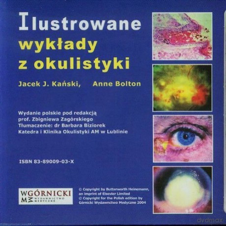 Ilustrowane wykłady z okulistyki - J. Kański Jacek, Anne Bolton [CD]