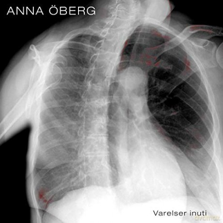 Anna Oberg: Anna Oberg [Winyl]