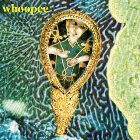 J Mcfarlane S Reality Guest: Whoopee [Winyl]