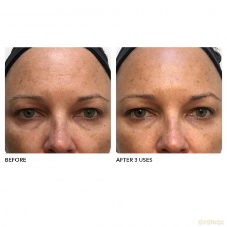 Algenist Blue Algae Vitamin C Dark Spot Correcting