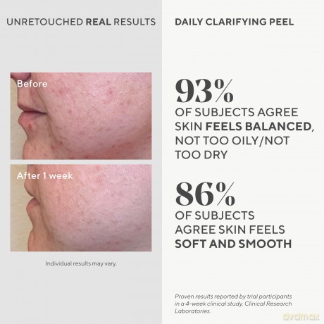 Murad - Daily Clarifying Peel 95 ml