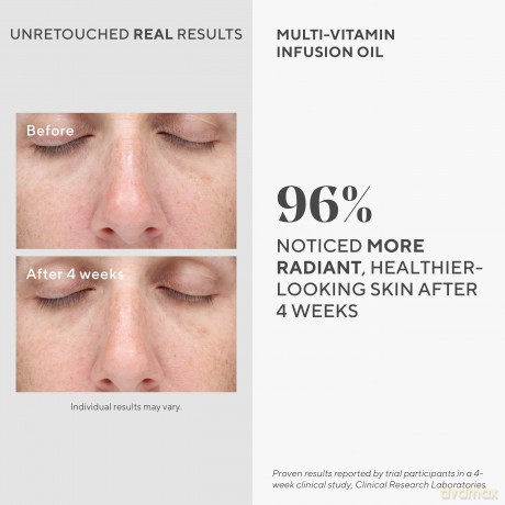 Murad - Multi-Vitamin Infusion Oil 30 ml