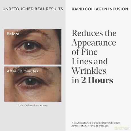 Murad - Resurgence Rapid Collagen Infusion 30 ml