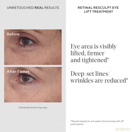 Murad - Resurgence Retinal Rescuplt Eye Lift Treatment 15 ml