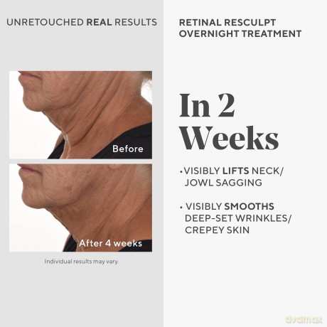 Krem do twarzy Murad - Retinal ReSculpt Overnight Treatment 30 ml