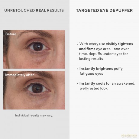 Murad - Targeted Eye Deduffer 15 ml