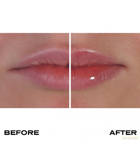 Plump It! - Collagen Lip Plumper Transparent 3 ml