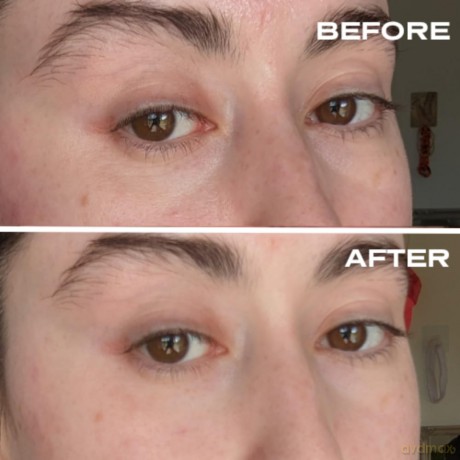 Plump It! - No Needles Dermal Filler Transparent 15 x 0,67 ml