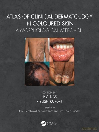 Atlas of Clinical Dermatology in Coloured Skin: A Morphological Approach - P C Das [KSIĄŻKA]