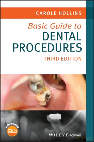 Basic Guide to Dental Procedures (Basic Guide Dentistry Series) - Carole Hollins [KSIĄŻKA]