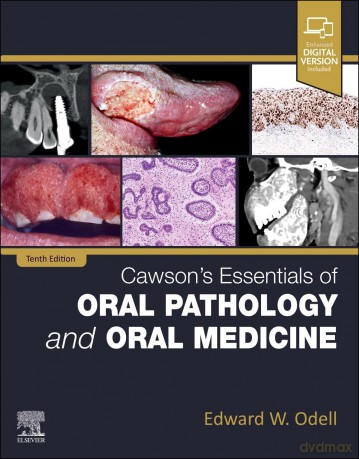 Cawson's Essentials of Oral Pathology and Oral Medicine - Daisy Wood [KSIĄŻKA]