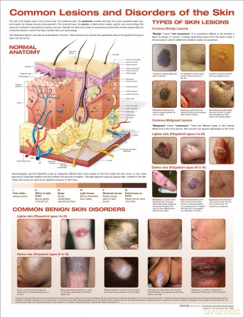 Common Lesions and Disorders of the Skin Anatomical Chart - Anatomical Chart Company [KSIĄŻKA]