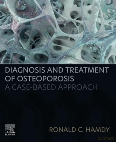 Diagnosis and Treatment of Osteoporosis: A Case-Based Approach - Charlotte Butterfield [KSIĄŻKA]