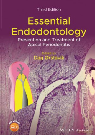 Essential Endodontology: Prevention and Treatment of Apical Periodontitis - Dag Orstavik [KSIĄŻKA]