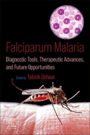 Falciparum Malaria: Diagnostic Tools, Therapeutic Advances, and Future Opportunities - Helen Scales [KSIĄŻKA]
