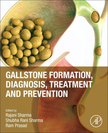 Gallstone Formation, Diagnosis, Treatment and Prevention - Jeff Kinney [KSIĄŻKA]