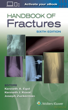 Handbook of Fractures - Kenneth Egol MD [KSIĄŻKA]