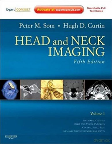 Head and Neck Imaging [KSIĄŻKA]