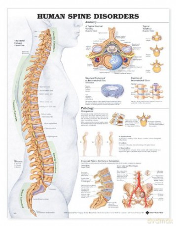 Human Spine Disorders - Anatomical Chart Company [KSIĄŻKA]