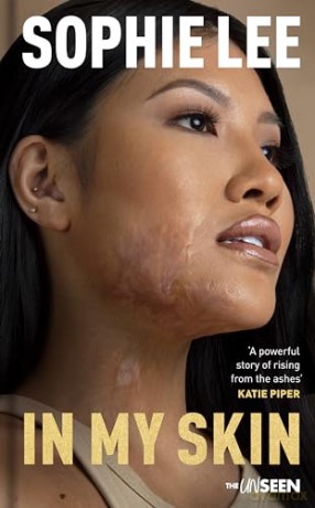In My Skin: Learning to love your perfectly imperfect life (Katie Piper's The UnSeen) - Sophie Lee [KSIĄŻKA]