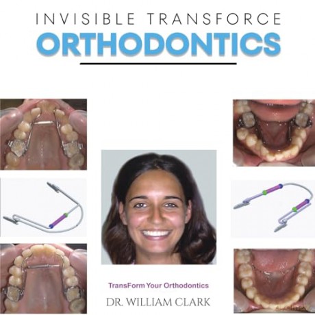 Invisible TransForce Orthodontics - Dr. William Clark [KSIĄŻKA]