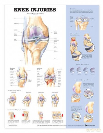Knee Injuries - Anatomical Chart Company [KSIĄŻKA]