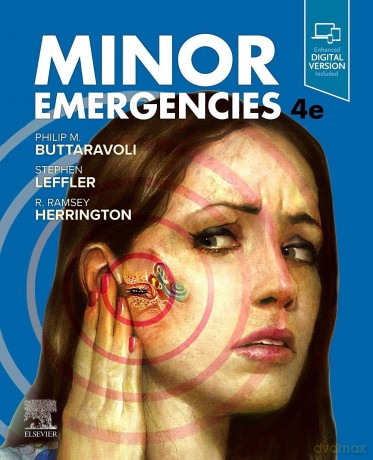 Minor Emergencies: Expert Consult - Online and Print - Adam Hargreaves [KSIĄŻKA]