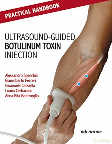 Practical Handbook for Ultrasound-guided Botulinum Toxin Injection - Alessandro Specchia [KSIĄŻKA]