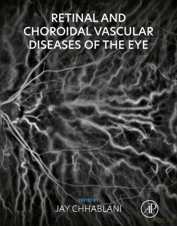 Retinal and Choroidal Vascular Diseases of the Eye - Lynley Dodd [KSIĄŻKA]