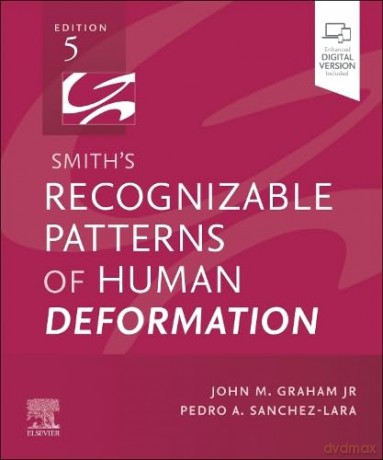 Smith's Recognizable Patterns of Human Deformation - Craig Zacker [KSIĄŻKA]
