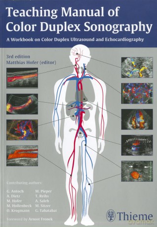 Teaching Manual of Color Duplex Sonography - Matthias Hofer [KSIĄŻKA]